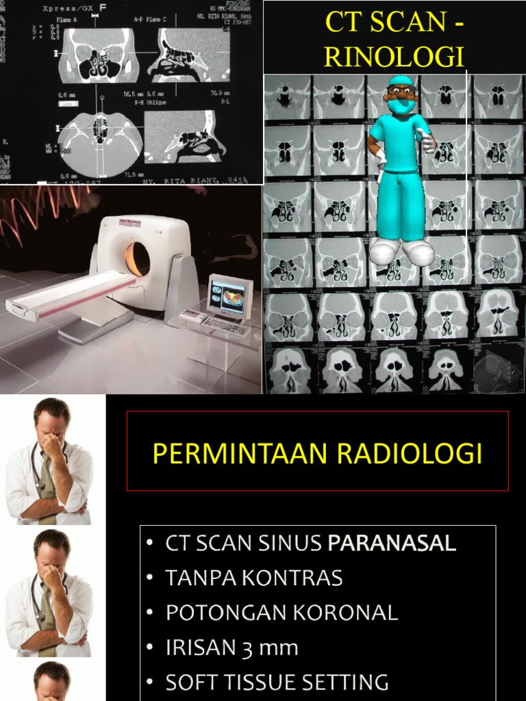 Ctscan SPN | PDF