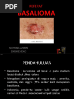 Download basalioma by Nofrina Arifin SN49393671 doc pdf