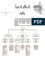 Tipos de Sillas