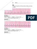 ECG Interpretation Practice