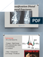 AO Classification Distal Femoral Fractures