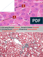 Pathology Anatomy Blok 4 Simulasi Ospe