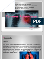 Tumores Pulmonares 2