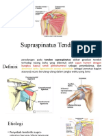 Supraspinatus Tendinitis