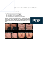 Ulthera Facial Tightening Without Surgery