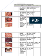 RANGKUMAN LESI-LESI INTRAORAL