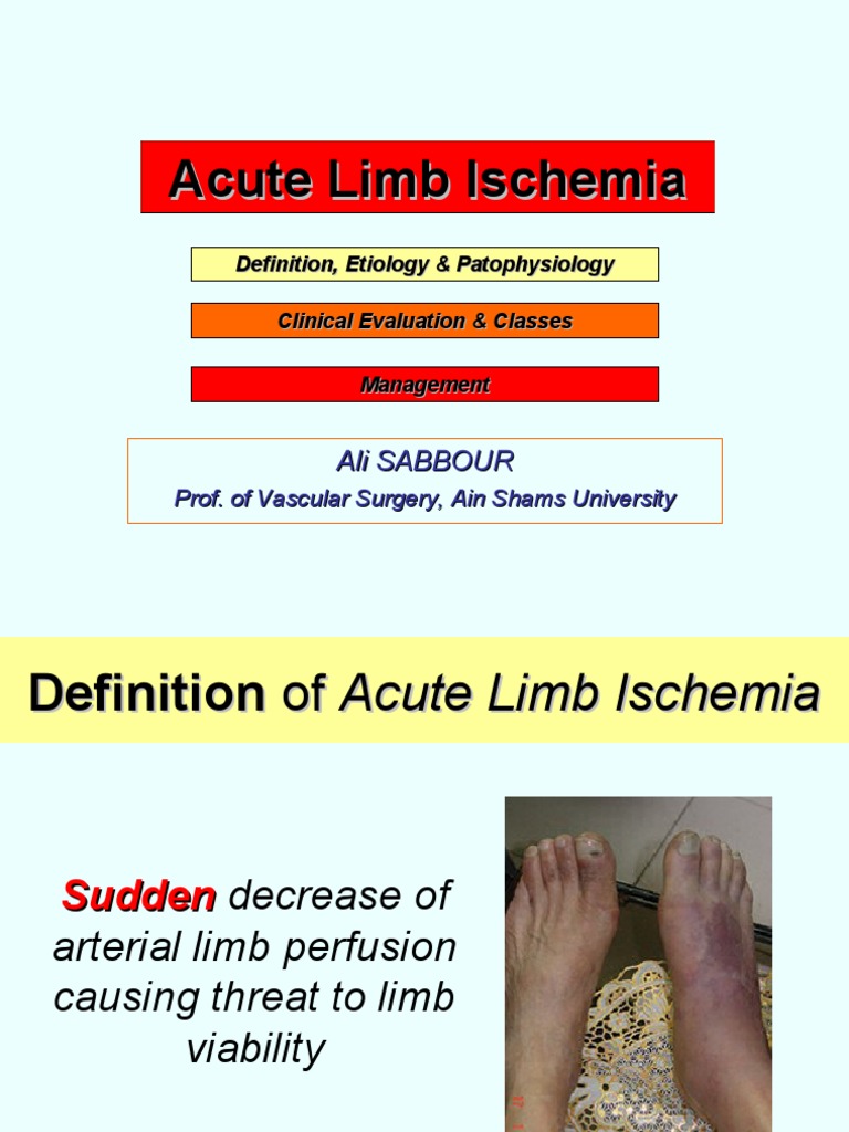 Acute Limb Ischemia Site | PDF | Ischemia | Thrombosis