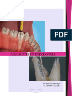 Accidentes en endodoncia: factores y prevención