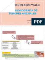 Ultrasonografía de Tumores Anexiales - Ayuda Al DX en Ginecobstetricia