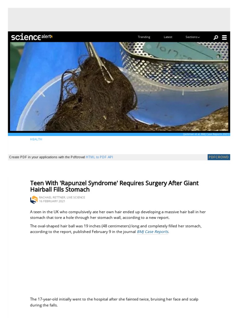 Teen With 'Rapunzel Syndrome' Requires Surgery After Giant Hairball(00)