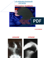 10 - Rhumatologie - Déformations Vertébrales