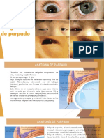 Anomalías Congénitas de Parpado