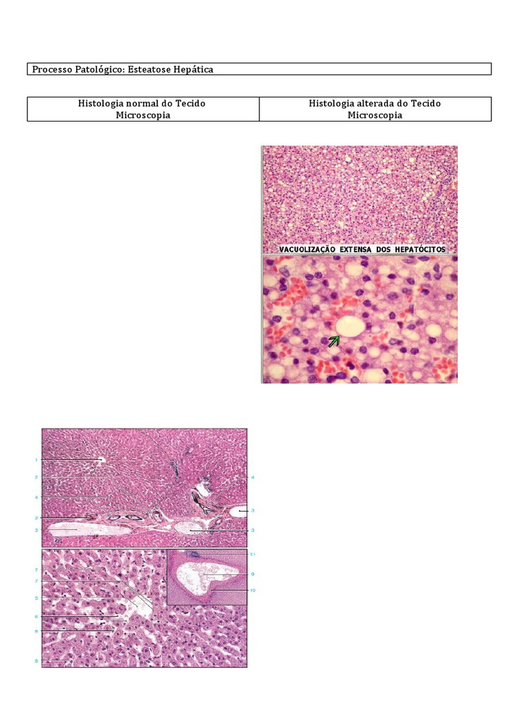Hígado: Anatomía | Concise Medical Knowledge, image size:768x1024