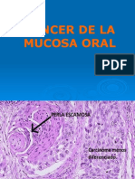 Uap-Patología-Cáncer de La Mucosa Oral-Procesos Inflamatorios y Tumorales de Gland. Salivales