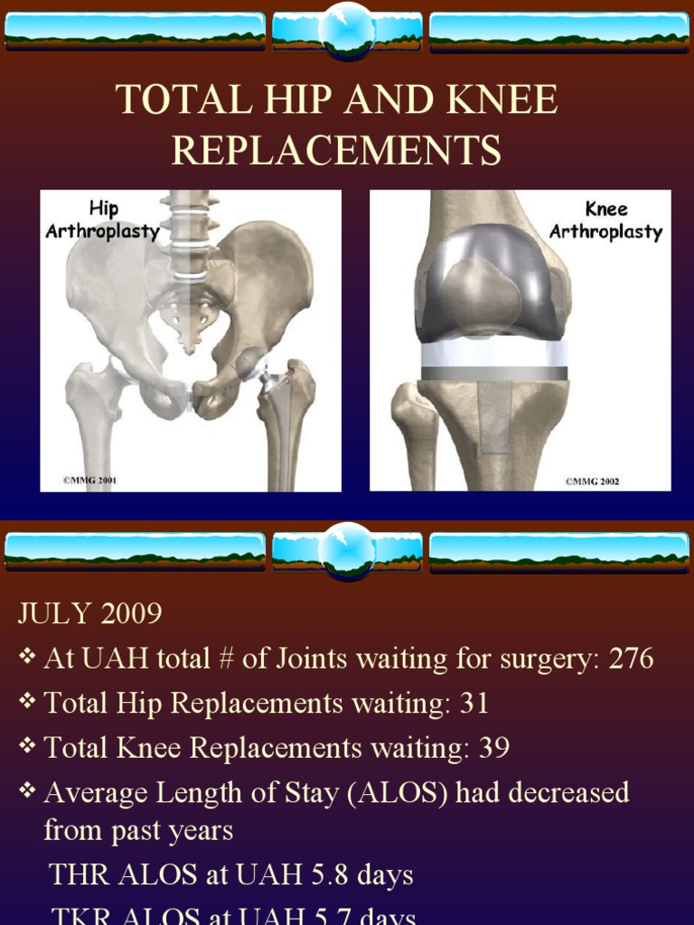 Total Hip and Knee Replacements | PDF | Hip | Anatomical Terms Of Motion