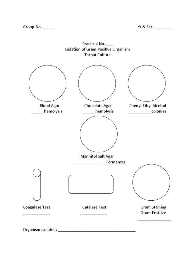 WORKSHEET GROUP THROAT AND URINE CULTURES