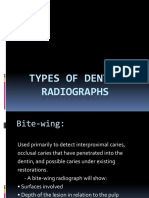 Types of Dental Radiographs