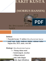 Morbus Hansen