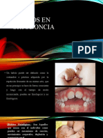 Hábitos en Ortodoncia
