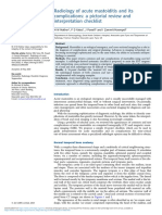 Radiology of Acute Mastoiditis and Its Complications: A Pictorial Review and Interpretation Checklist