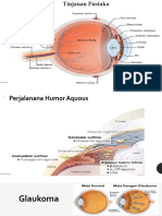 Case Glaukoma Kronis Sudut Terbuka
