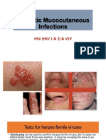 Herpetic Mucocutaneous Infections: HSV (HSV 1 & 2) & VZV