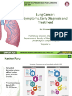 Lung Cancer Symptoms Early Diagnosis and Treatment