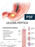 Ulcera Peptica (Clinica)