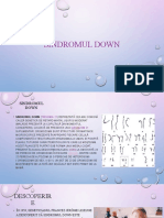 Sindromul Down