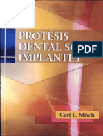 Carl Misch Protesis Dental Sobre Implantes