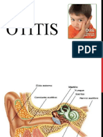 2 Otitis Quant