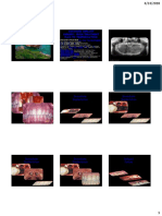 3 3D Radiographic Input in Planning For Advanced Implant