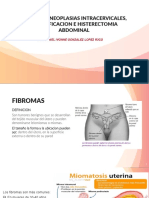 Expo Fibromas Histerectomia