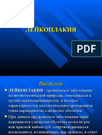 ЛЕЙКОПЛАКИЯ PPT