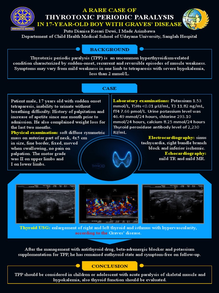 Thyrotoxic Periodic Paralysis A Rare Case of in 17YearOld Boy With