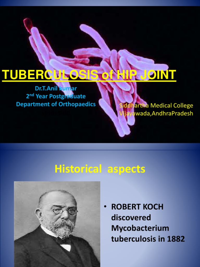 Tuberculosis of Hip Joint Siddssidd PDF Tuberculosis Clinical