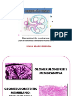 Glomerulopatías - II Parte