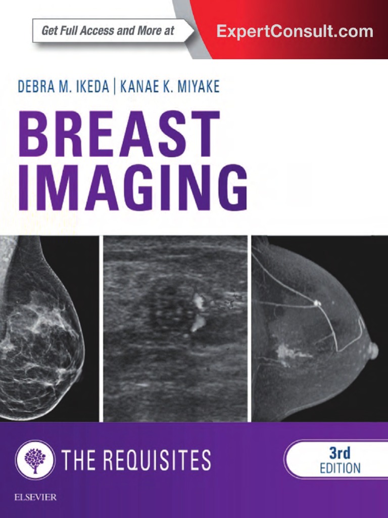 Breast Imaging - The Requisites, PDF, Mammography