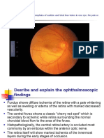 Case 1: 70-Yr Man Complains of Sudden and Total Loss Vision in One Eye. No Pain or Other Symptoms