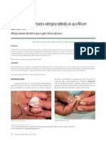 Dermatitis de Contacto Alérgica Debido Al Ajo Allium Sativum L