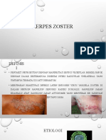 HERPES ZOSTER