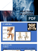 Fractura de cadera: causas, clasificaciones y tratamiento