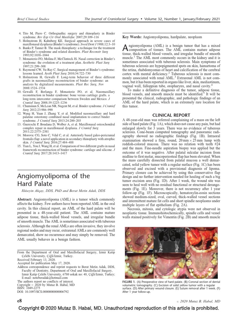 Angiomyolipoma of The Hard Palate: Clinical Report | PDF | Medical ...