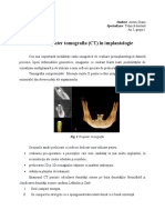 Computer Tomografia in Implantologie