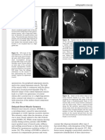 132 January-February 2018: Figure 12. Fluid Accumulation Dispro