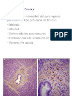 Pancreatitis Cronica