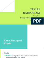 CT Scan Stroke Untuk Diagnosis Awal