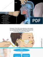 Pemasangan Nasogastric Tube