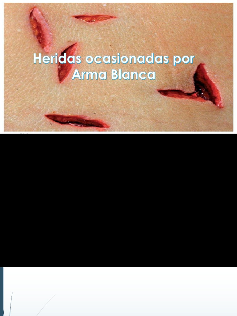 Heridas Ocasionadas Por Arma Blanca | PDF | Hoja | Sangre
