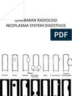 Neoplasm A